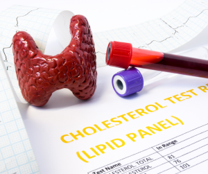 Tiroide e colesterolo